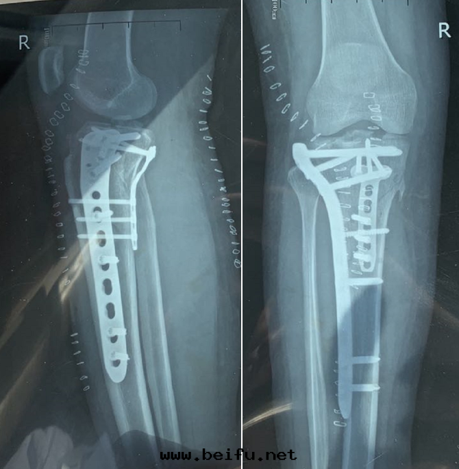 1616744786874392.png 1616744786874392.png