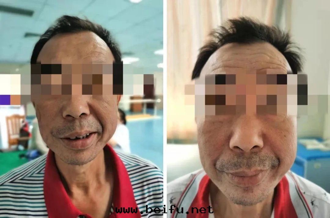 1617000546792090.jpg 1617000546792090.jpg